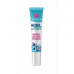 Acneclear Intensive Anti-Acne Treatment 15ml